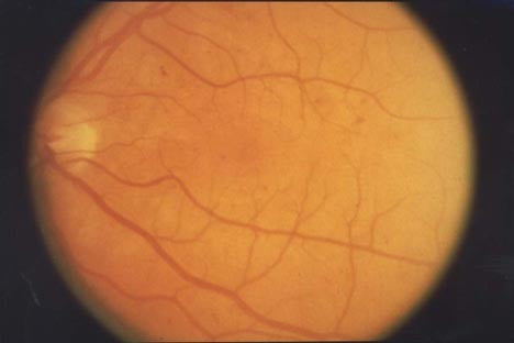 Inside the Retina | Eyetamins